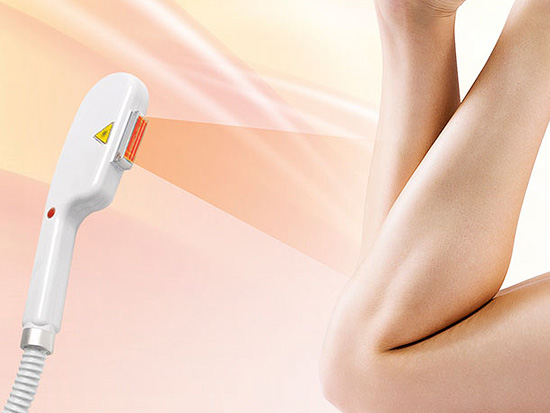 Best Laser Hair Removal Machine in Los Angles